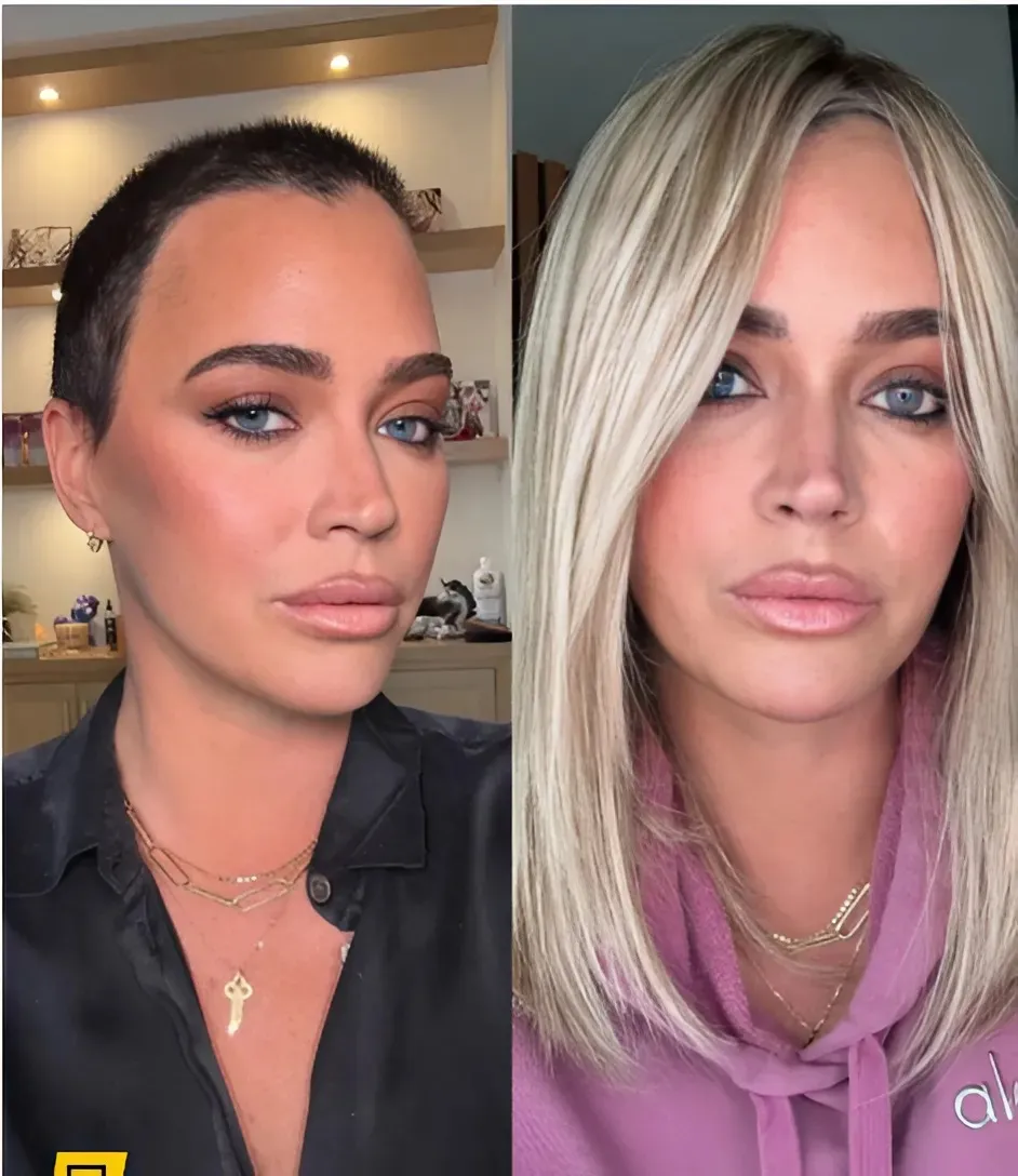 Teddi Mellencamp debates wearing ‘wig or no wig’ amid brain tumor journey