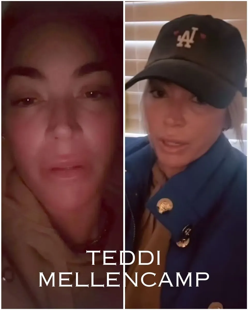 Teary-eyed Teddi Mellencamp gets real about ‘hard’ nights during cancer treatment