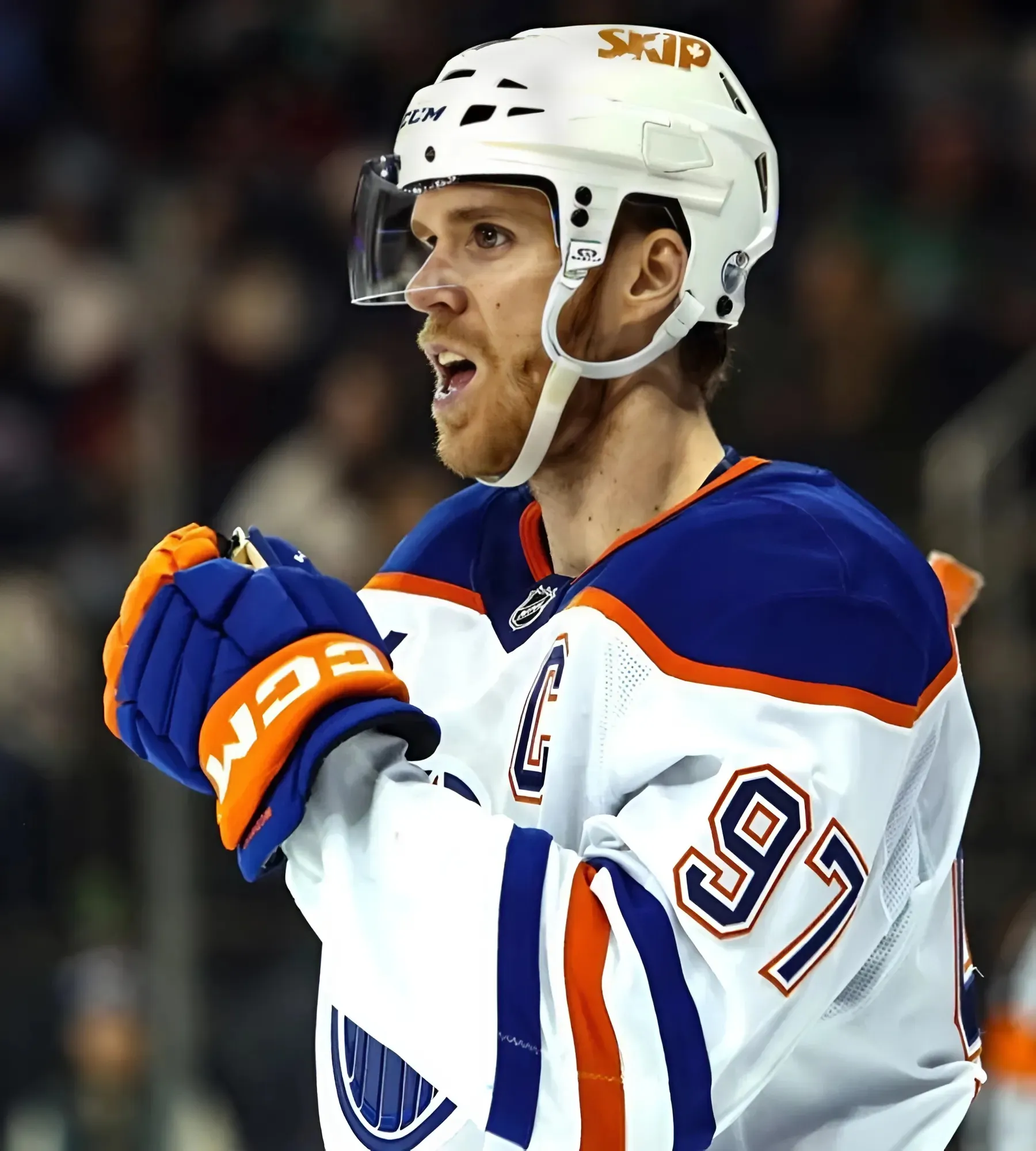 Oilers' Connor McDavid injured in OT loss to Jets