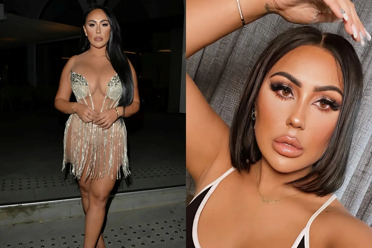 Geordie Shore’s Sophie Kasaei shows off ‘sunken face and eyes’ after having all her face filler dissolved liennhi