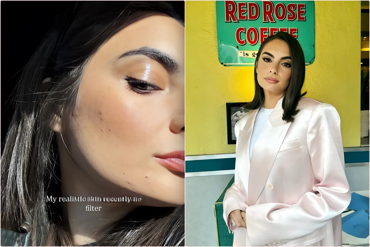 PHOTO: Paige DeSorbo Posts Unfiltered Pic of Acne and “Realistic Skin,” Plus Summer House Star Shares Cryptic Post About Men Needing to Be Told They Are “Losers” - lulu