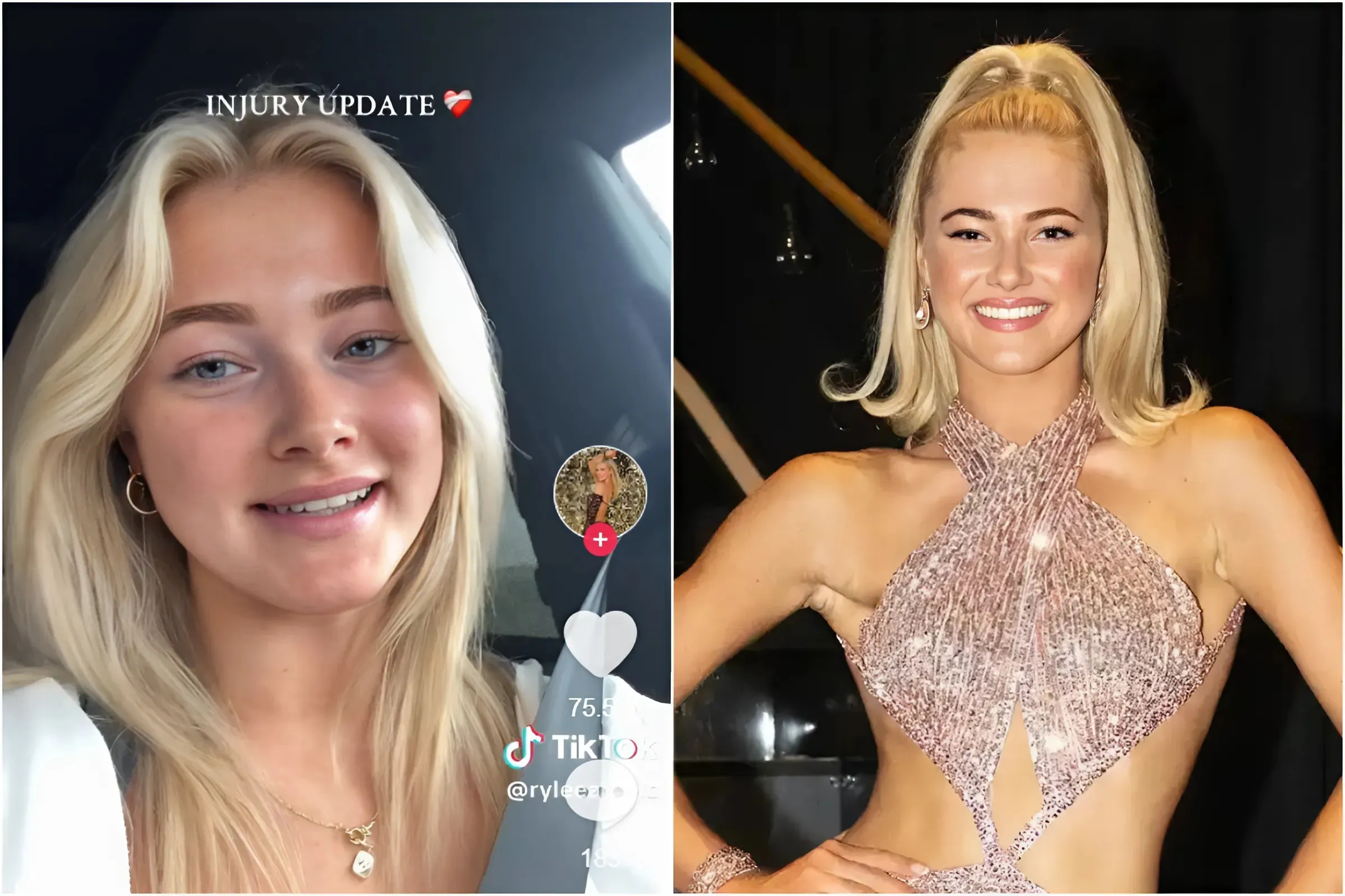 'Dancing with the Stars' Star Rylee Arnold Forced to Sit Out Tour Due to Injury trucc