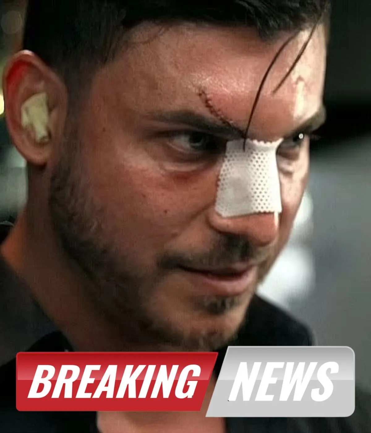Jax Taylor makes shock plastic surgery admission after admitting to huge cocaine use