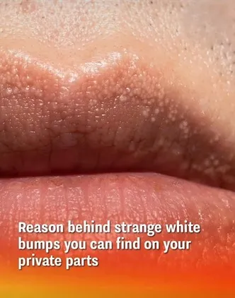 Reason behind strange white bumps found on your private parts