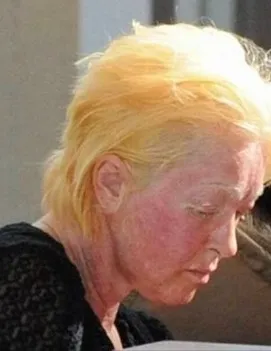 Cyndi Lauper deals with illness that causes severe pain Cyndi Lauper deals with illness that causes severe pain