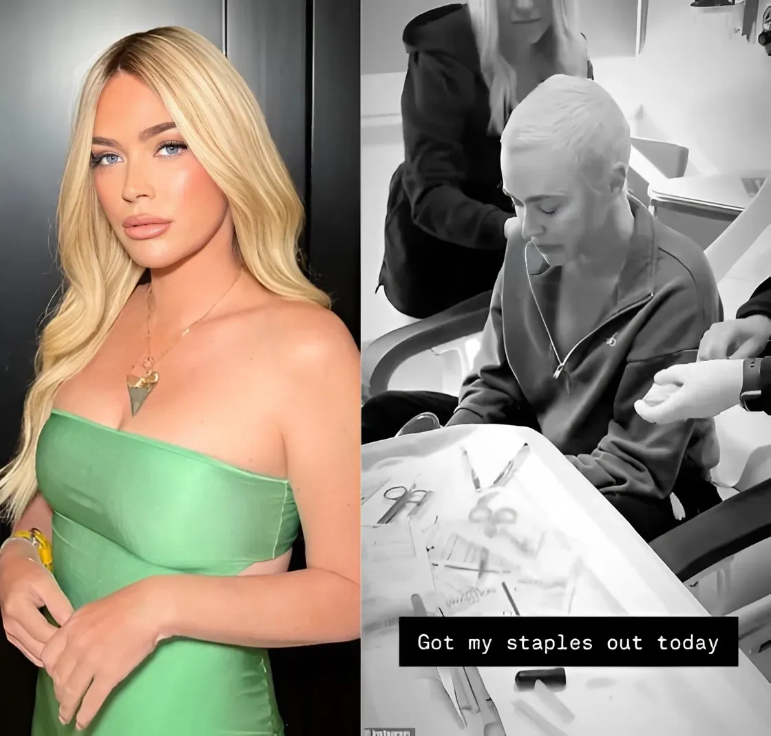 RHOBH’s Teddi Mellencamp on Getting 50/50 Chance of Surviving Brain Cancer and Being “Scared,” Plus Kyle and Edwin’s Support, “Hardest Part” of Health Battle, and How She’s Coping