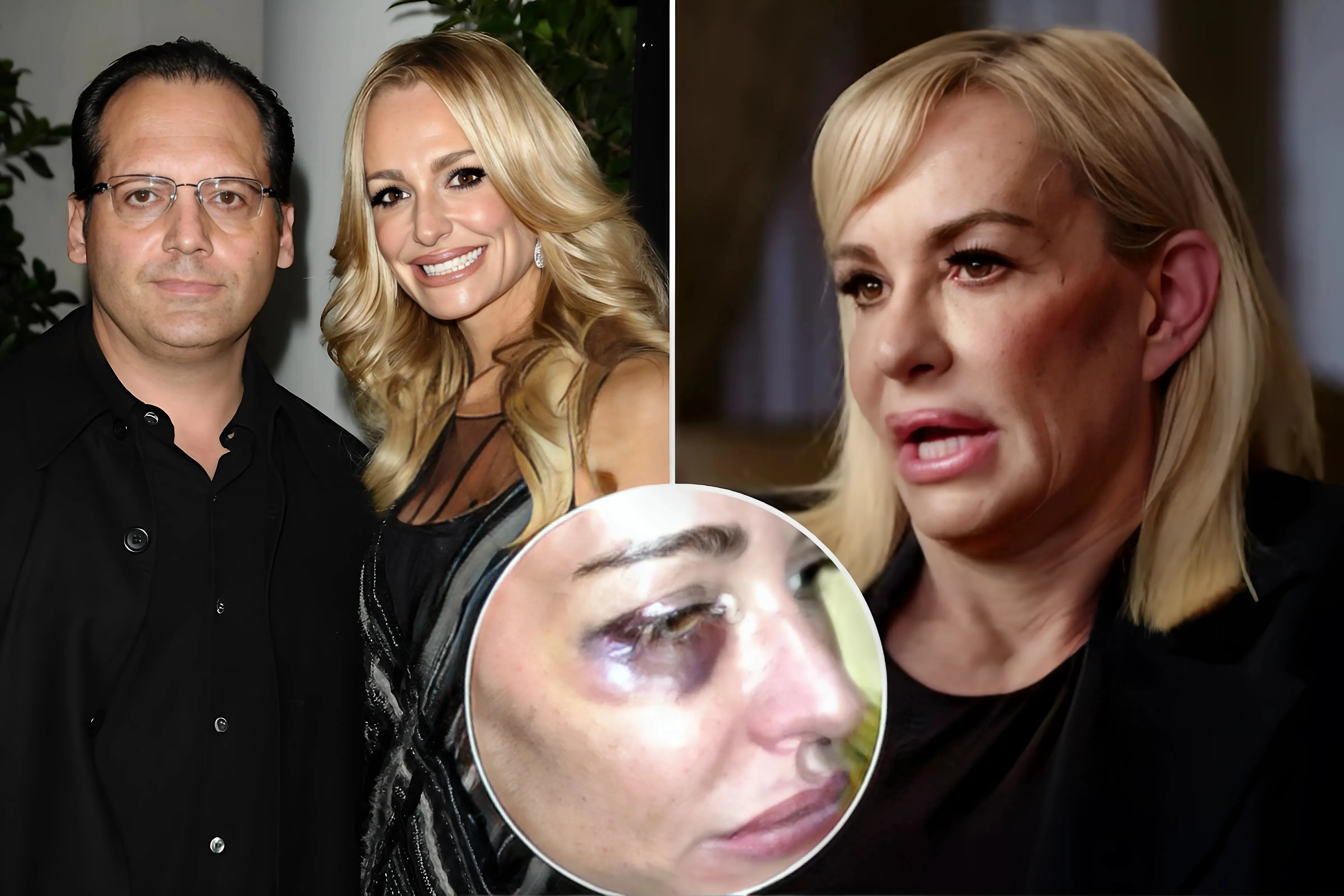 'RHOBH' Taylor Armstrong Claims Late Husband Punched Her So Hard He Broke Her Face 'RHOBH' Taylor Armstrong Claims Late Husband Punched Her So Hard He Broke Her Face