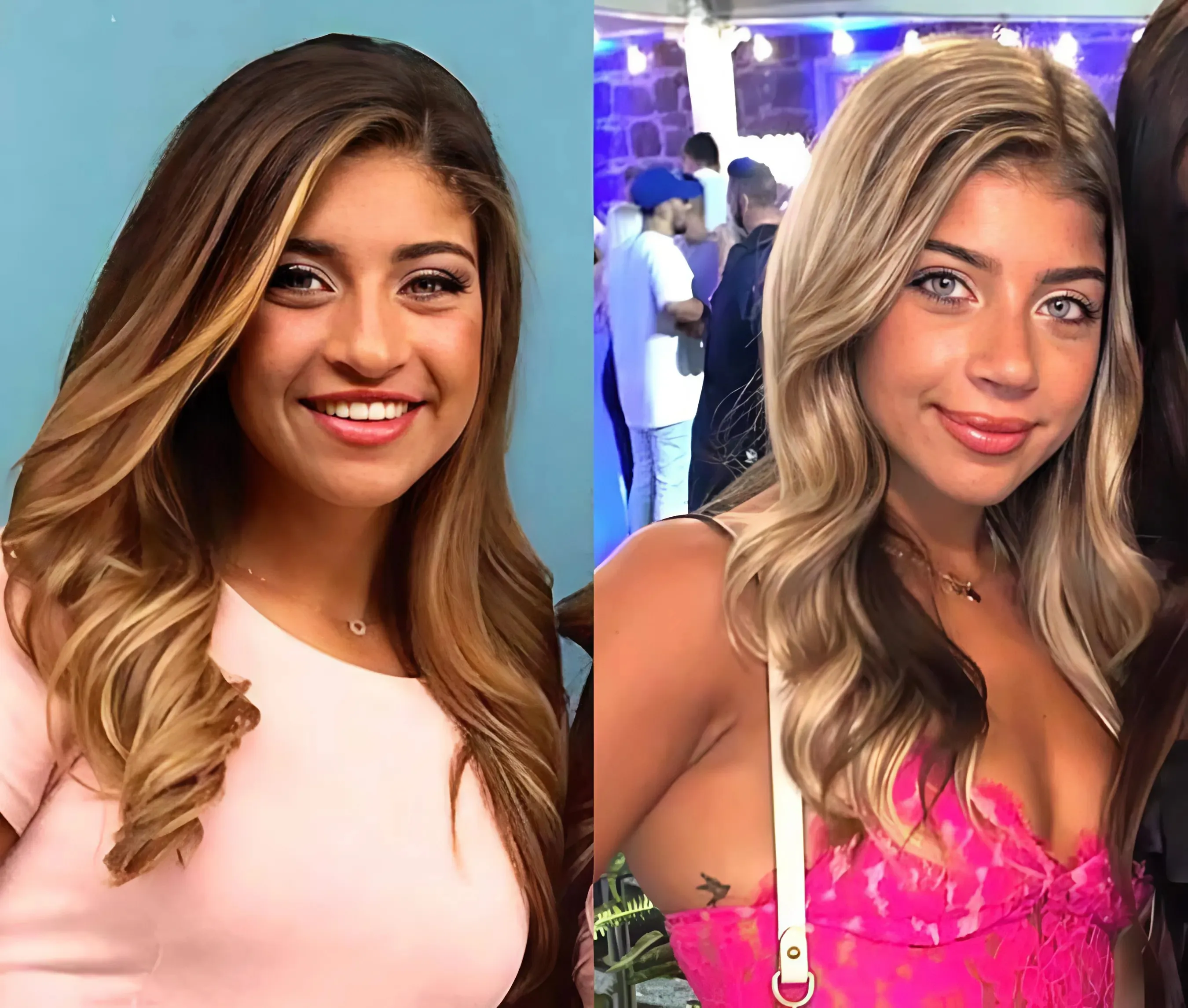 RHONJ’s Gia Giudice Shares What Plastic Surgery She’s Had Done as She Denies Using Fillers and Talks “Very Natural Look” RHONJ’s Gia Giudice Shares What Plastic Surgery She’s Had Done as She Denies Using Fillers and Talks “Very Natural Look”