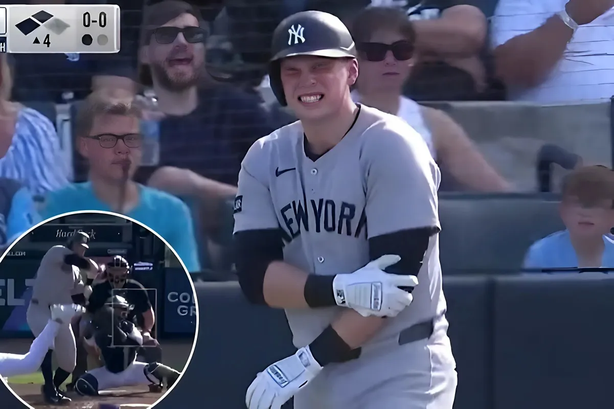 Yankees' Ben Rice Forced to Exit Game with Elbow Contusion After Being Hit by Pitch, Team Concerned - lulu