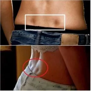 P1.  What Lower Back Dimples Really Mean: Facts About “Venus Holes” and Their Role in Body Anatomy