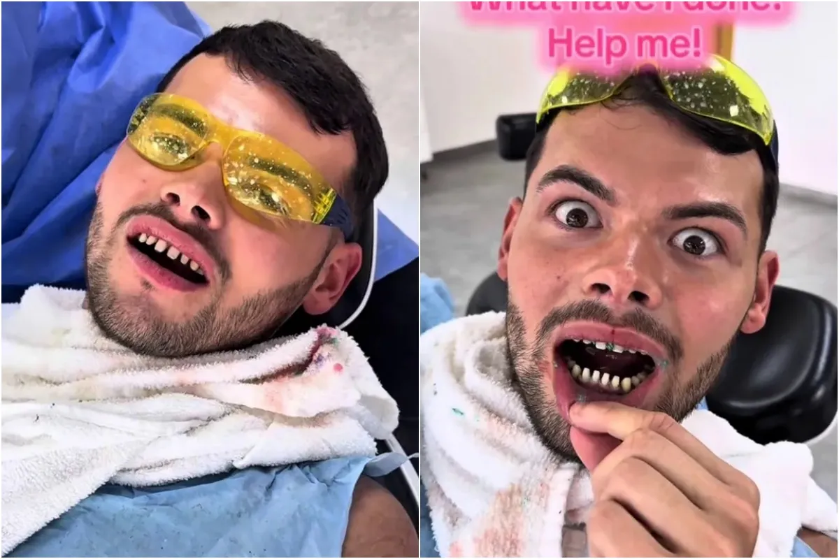 Towie’s Joe Blackman shares gruesome snaps of teeth ground down to bloody stumps ahead of getting new Turkey teeth ngocc