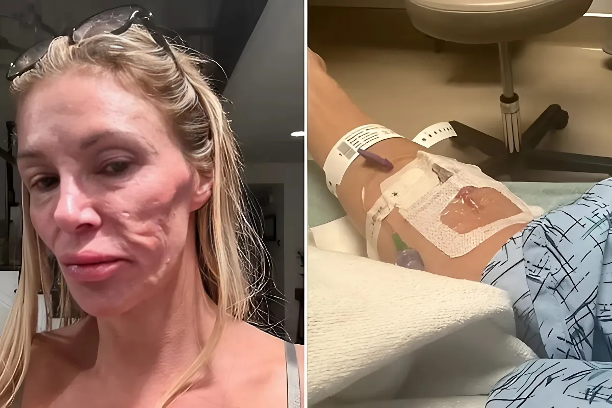 Brandi Glanville rushed to hospital after frantic 911 call amid facial parasite battle - lulu