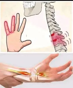 P3. Numb Hands: Is It Normal or a Sign of a Problem?