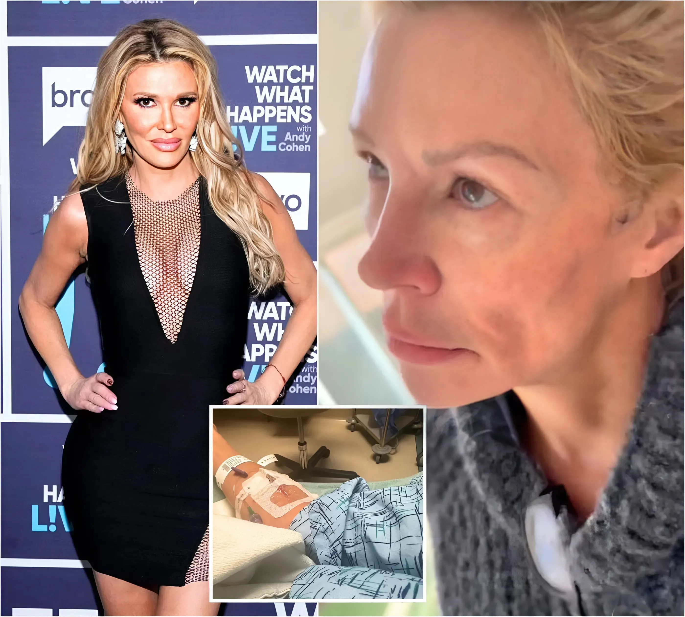 Brandi Glanville rushed to hospital after frantic 911 call amid facial parasite battle