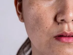 S4. Skin Condition: Signs on skin that may be indicative of serious diseases