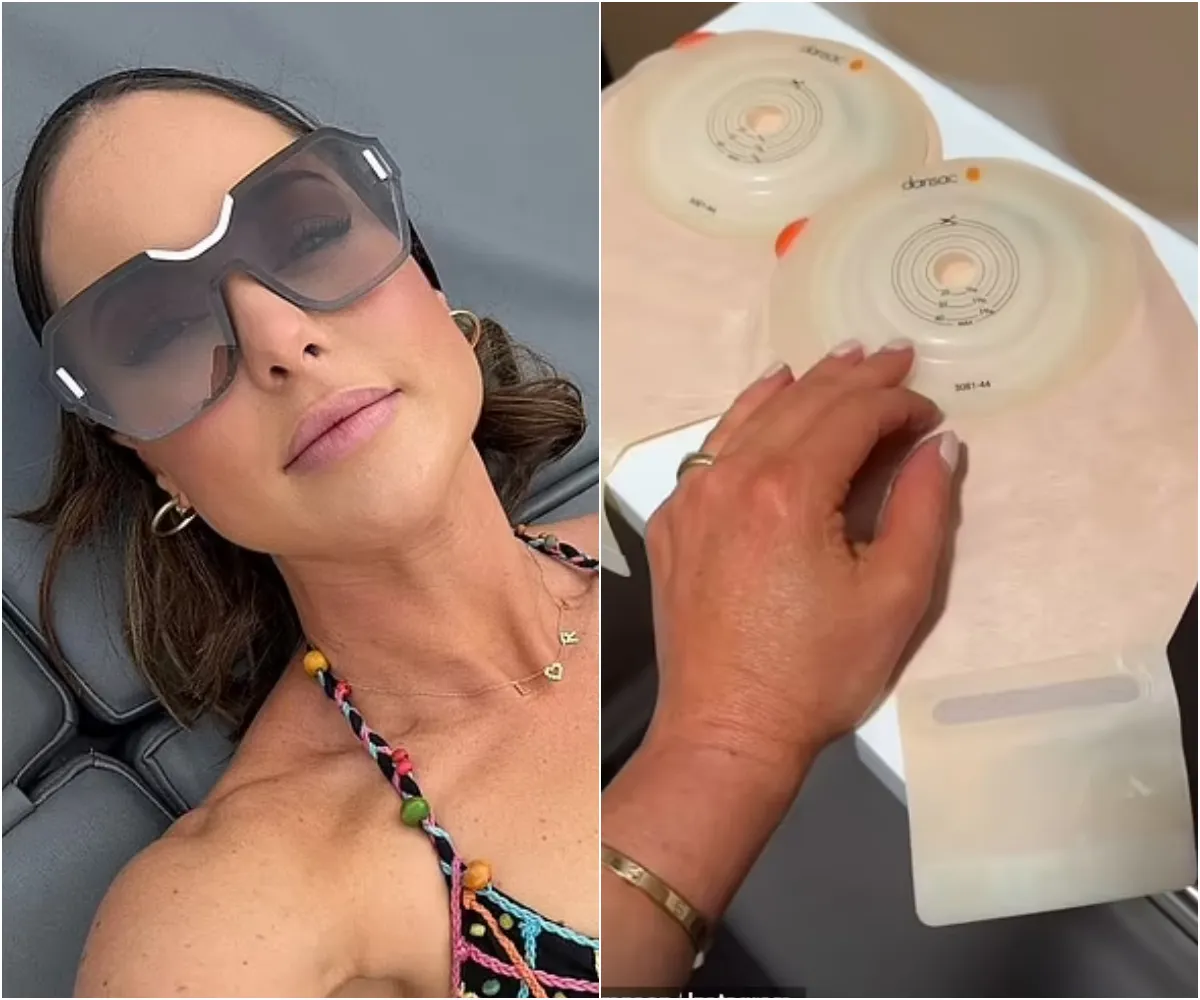 Louise Thompson bursts into tears and is left 'too overwhelmed to speak' after suffering 'horrendously debilitating' stoma leak during London outing - suong