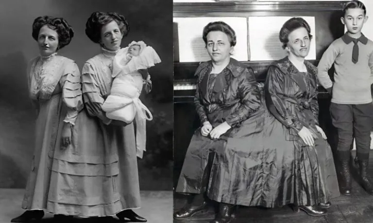 5.. The Incredible Story of the Siamese Twins: One Fell in Love, Had a Baby — and Both Became Mothers... 5.. The Incredible Story of the Siamese Twins: One Fell in Love, Had a Baby — and Both Became Mothers...