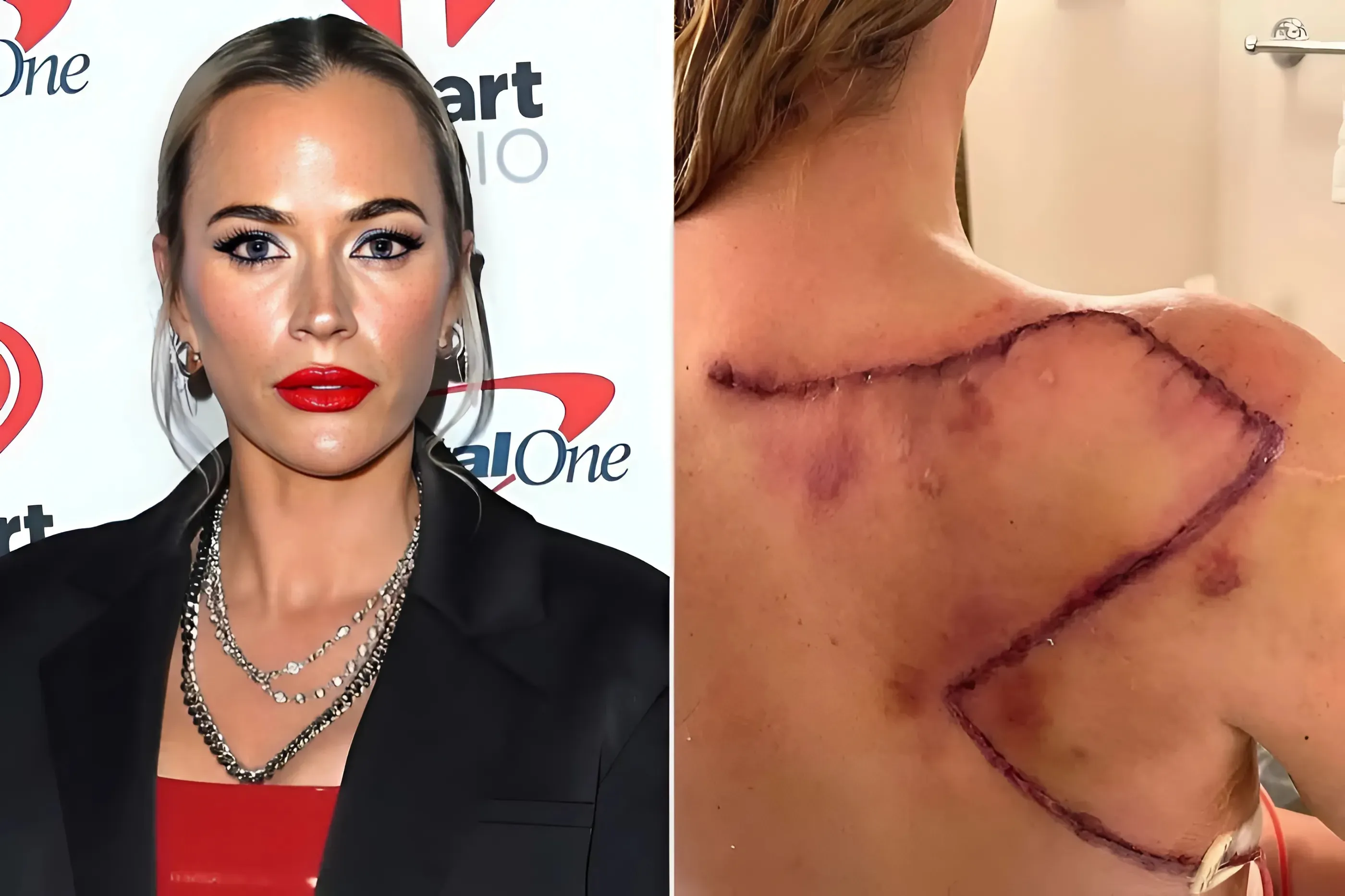 Teddi Mellencamp Cried Upon Seeing Cancer Scars and Hair Regrowth but Has Since Found 'Peace'