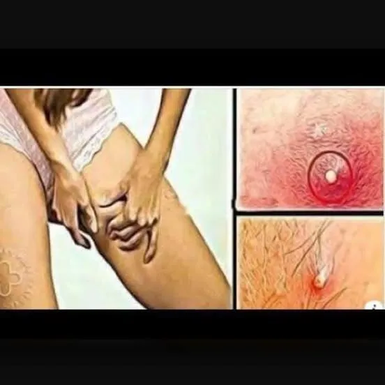 BE CAREFUL, If you spot these dots on your skin, it means you have Ca…see more