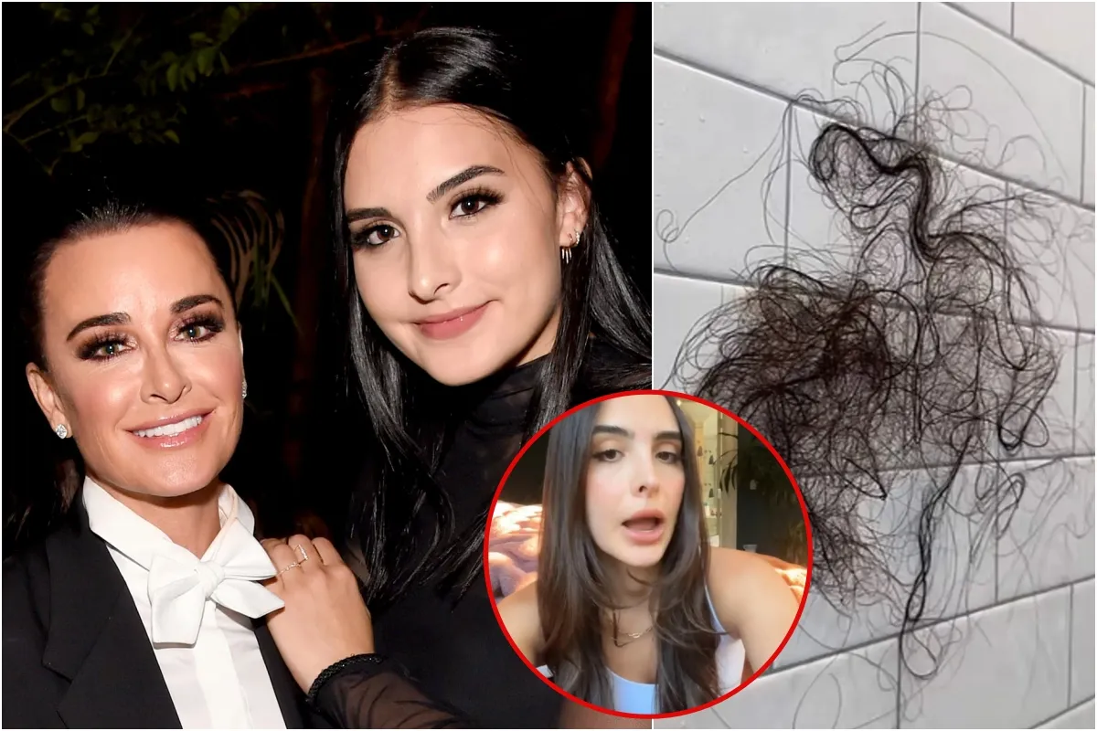 Kyle Richards’ daughter Sophia, 25, reveals shock hair loss after taking weight-loss drug: ‘I’m gonna be bald’-copy
