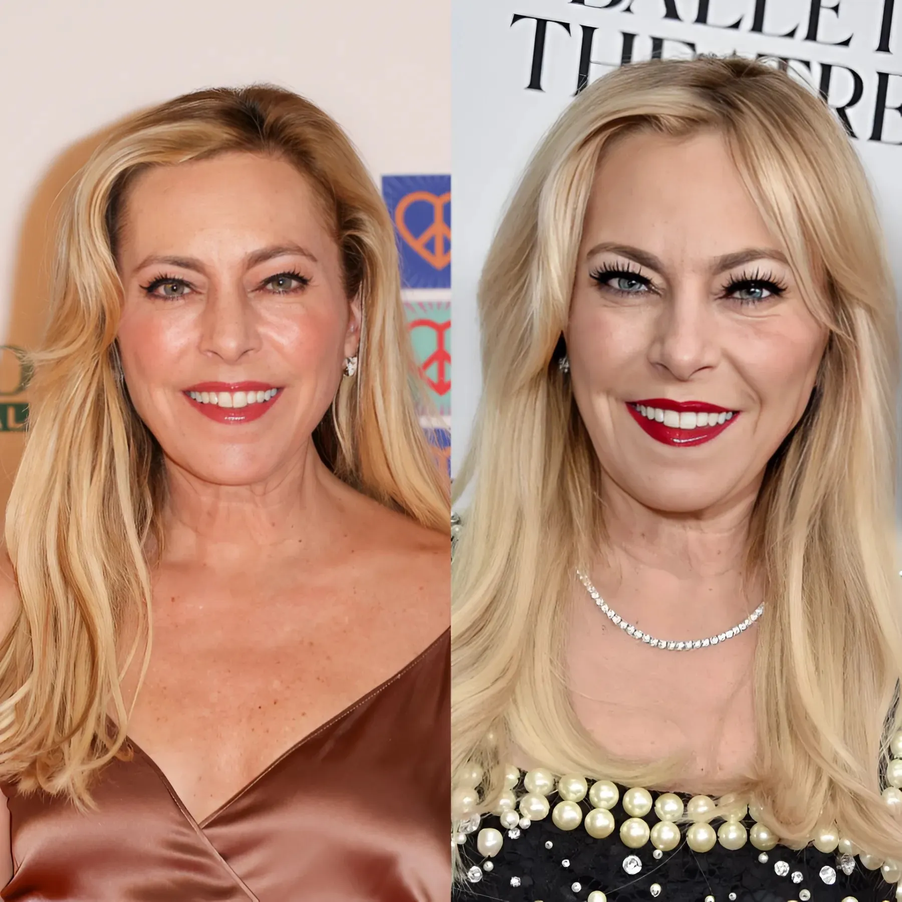 RHOBH’s Sutton Stracke Claps Back at Body Shamers Joking That She Skipped “Leg Day” After Sharing New Pics