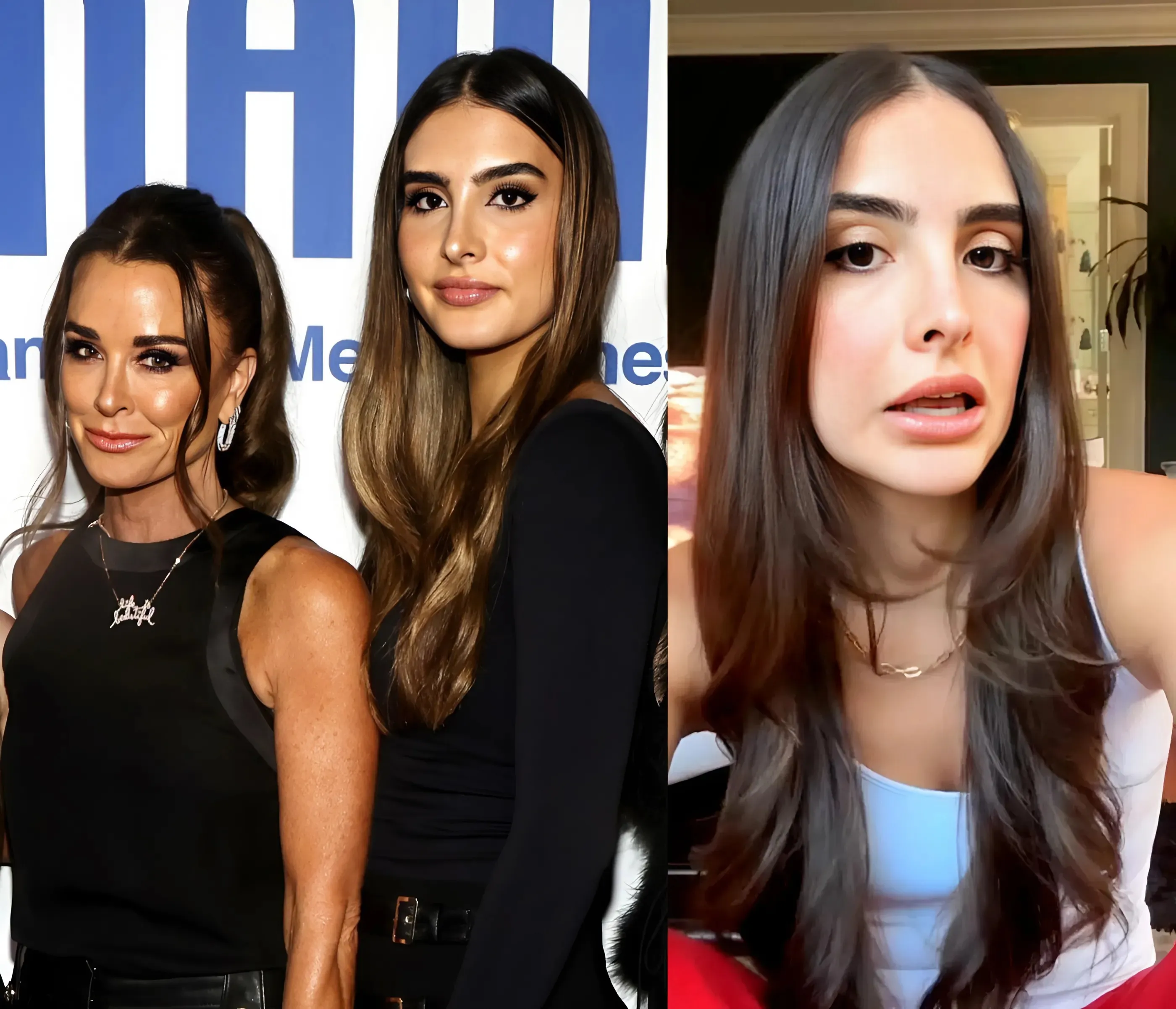 PHOTO: Kyle Richards’ Daughter Sophia Shows Her “Dramatic” Hair Loss After Taking Weight Loss Drug Mounjaro