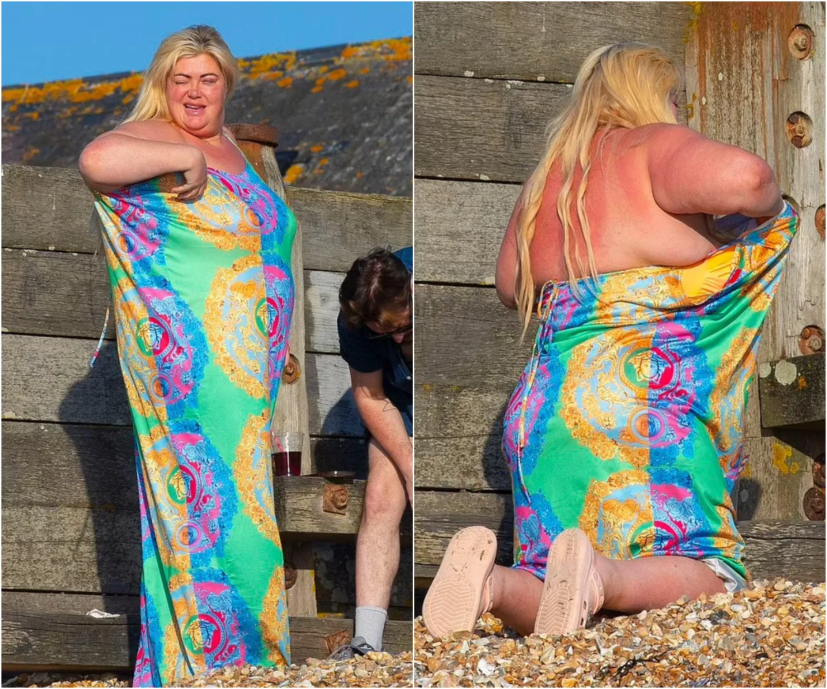 Gemma Collins risks serious sunburn as she hits Whitstable beach in colourful dress - after revealing Mounjaro helped her lose two stone - suong