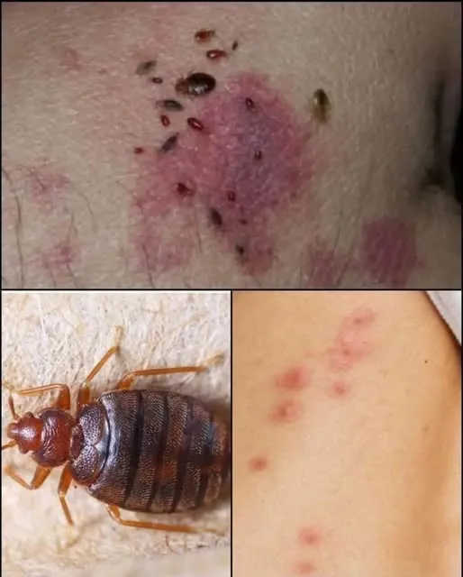 BE CAREFUL, If you spot these dots on your skin...