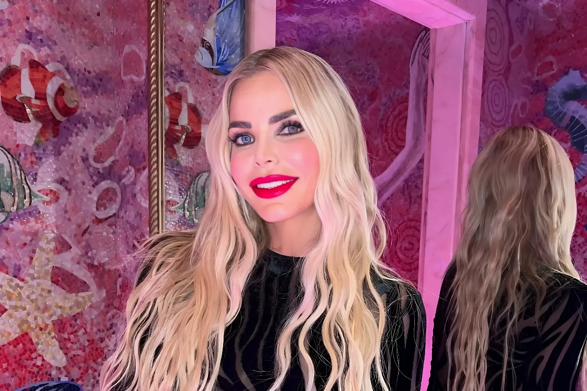 RHOM’s Alexia Nepola Explains Mysterious Bruise Seen at Finale, Shares Update tram
