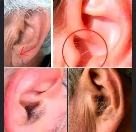 9. Did you know that if your ear hairs grow, it is because your body is