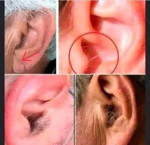 P2. Did you know that if your ear hairs grow, it is because your body is