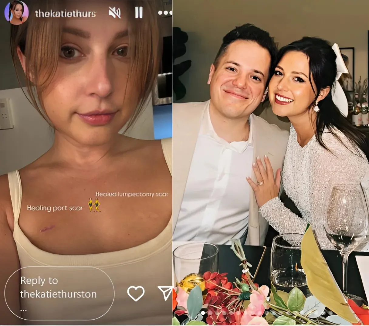‘Bachelorette’ Katie Thurston Reveals Next Steps In Cancer Fight