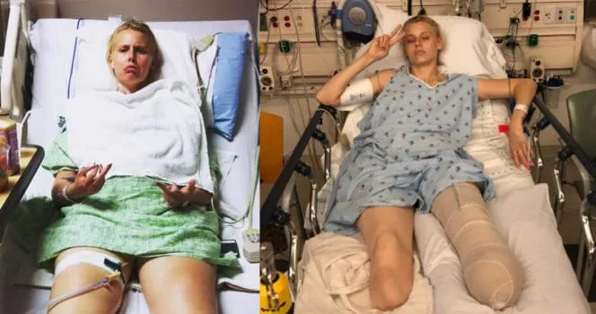 9. Her legs are amputated after using a common household product