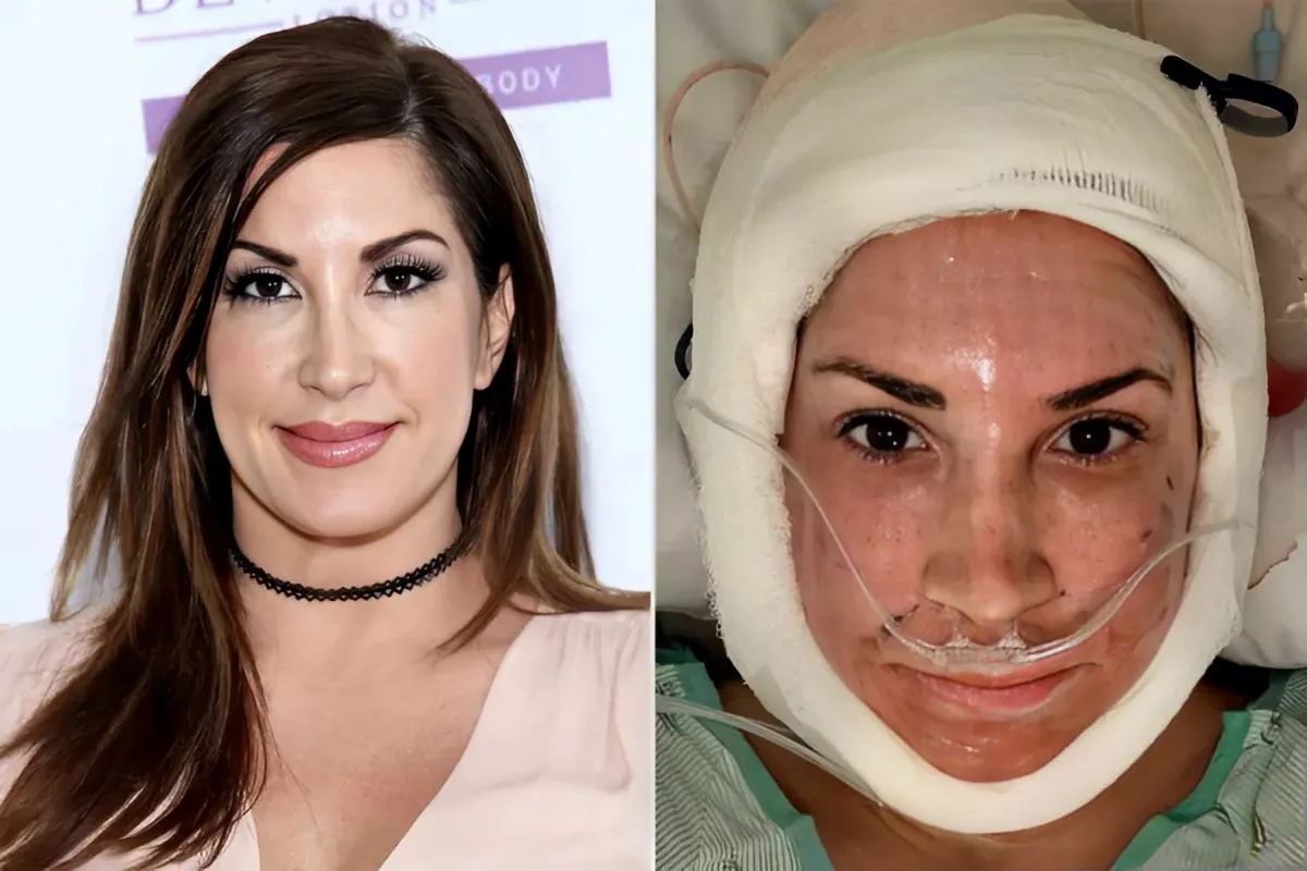 'RHONJ' Alum Jacqueline Laurita Shares Video After Cosmetic Surgery: 'Waiting for the Other Half of My Face to Wake Up!'-quang