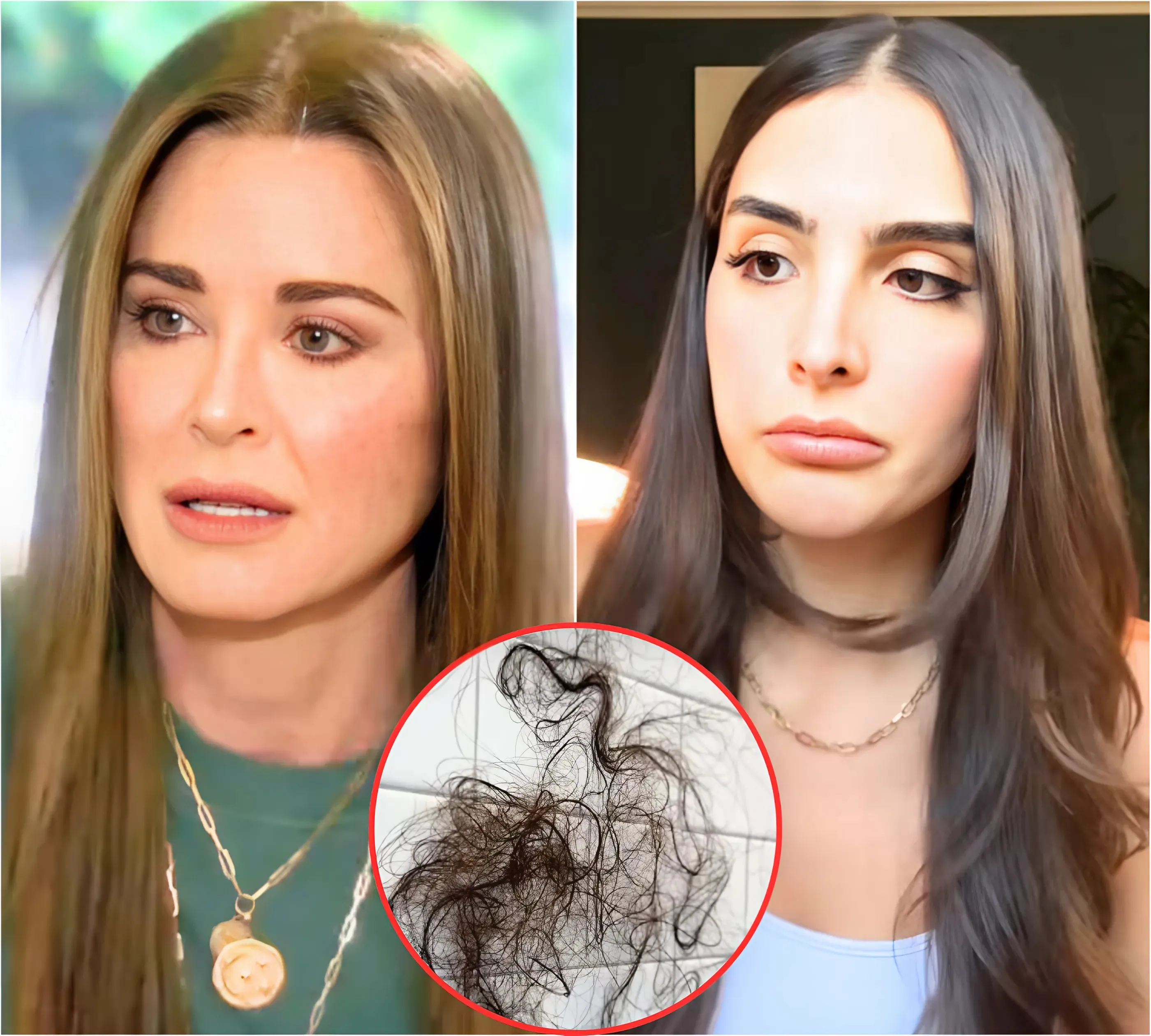 Kyle Richards’ Heartbreak Reaches New Heights as Daughter Sophia’s Mounjaro Weight Loss Triggers Haunting Memories of Her Anorexia Battle and Hair Loss Horror