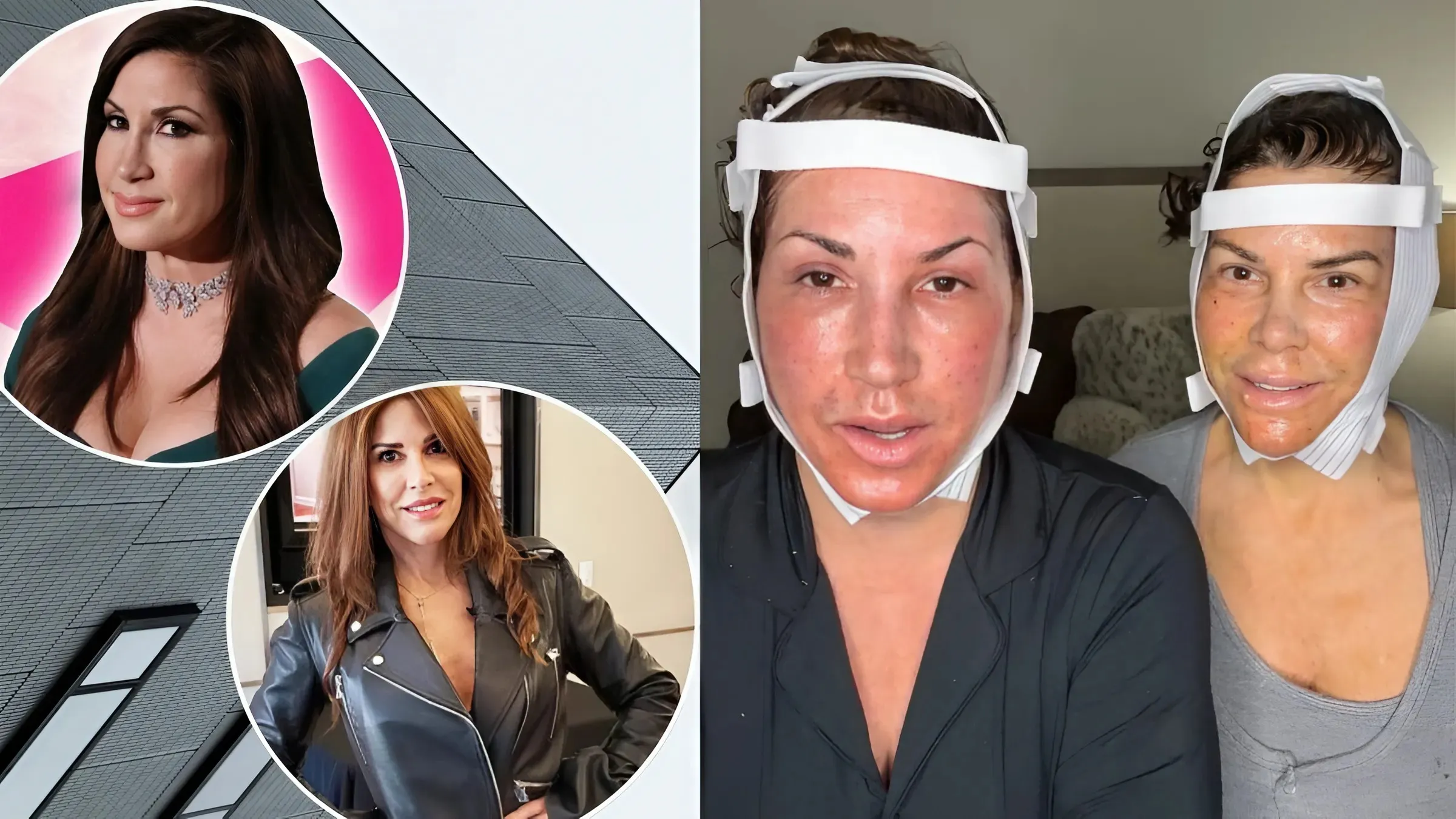 RHONJ’s Jacqueline Laurita Undergoes Facelift and Neck Lift With Lynne Curtin, Shares Post-Surgery Update as They Claim It “Doesn’t Even Hurt”