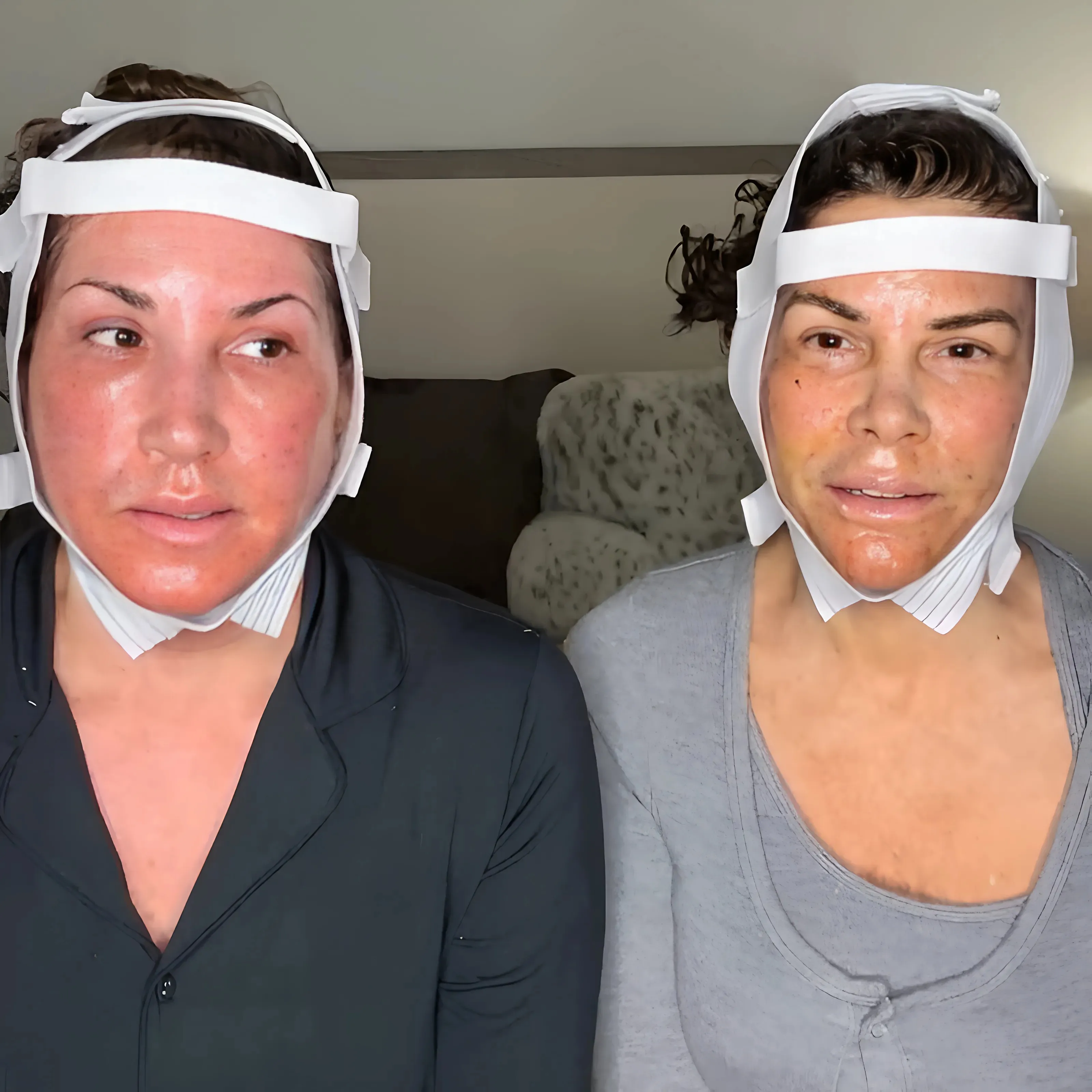 VIDEO : RHONJ’s Jacqueline Laurita Undergoes Facelift and Neck Lift With Lynne Curtin, Shares Post-Surgery Update as They Claim It “Doesn’t Even Hurt”
