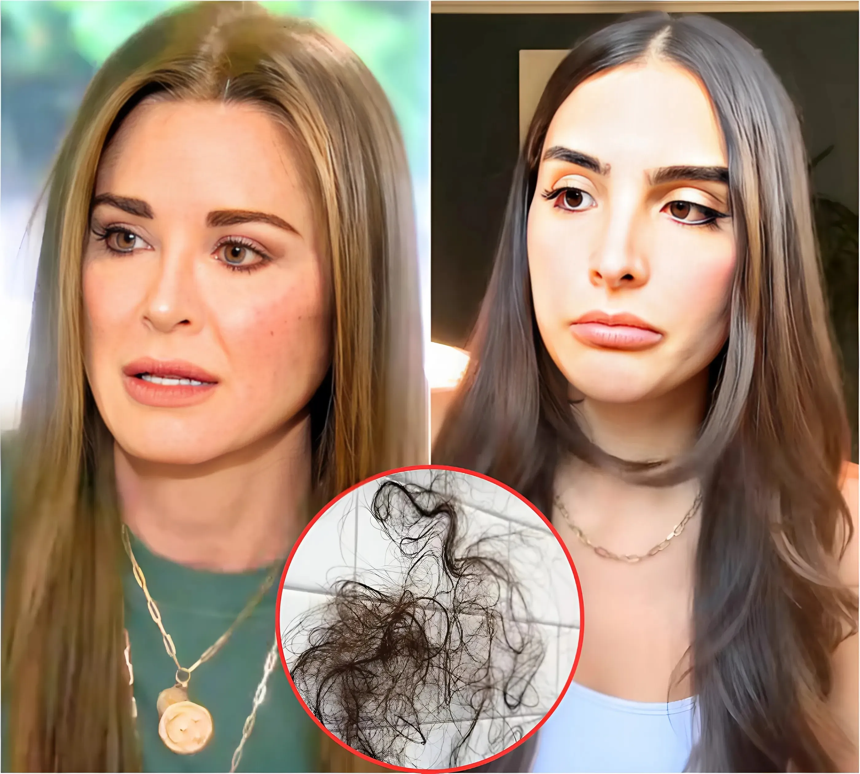 RHOBH HEARTBREAK: Kyle Richards Devastated as Daughter Sophia’s Mounjaro Use Sparks Painful Anorexia Flashbacks and Hair Loss Crisis