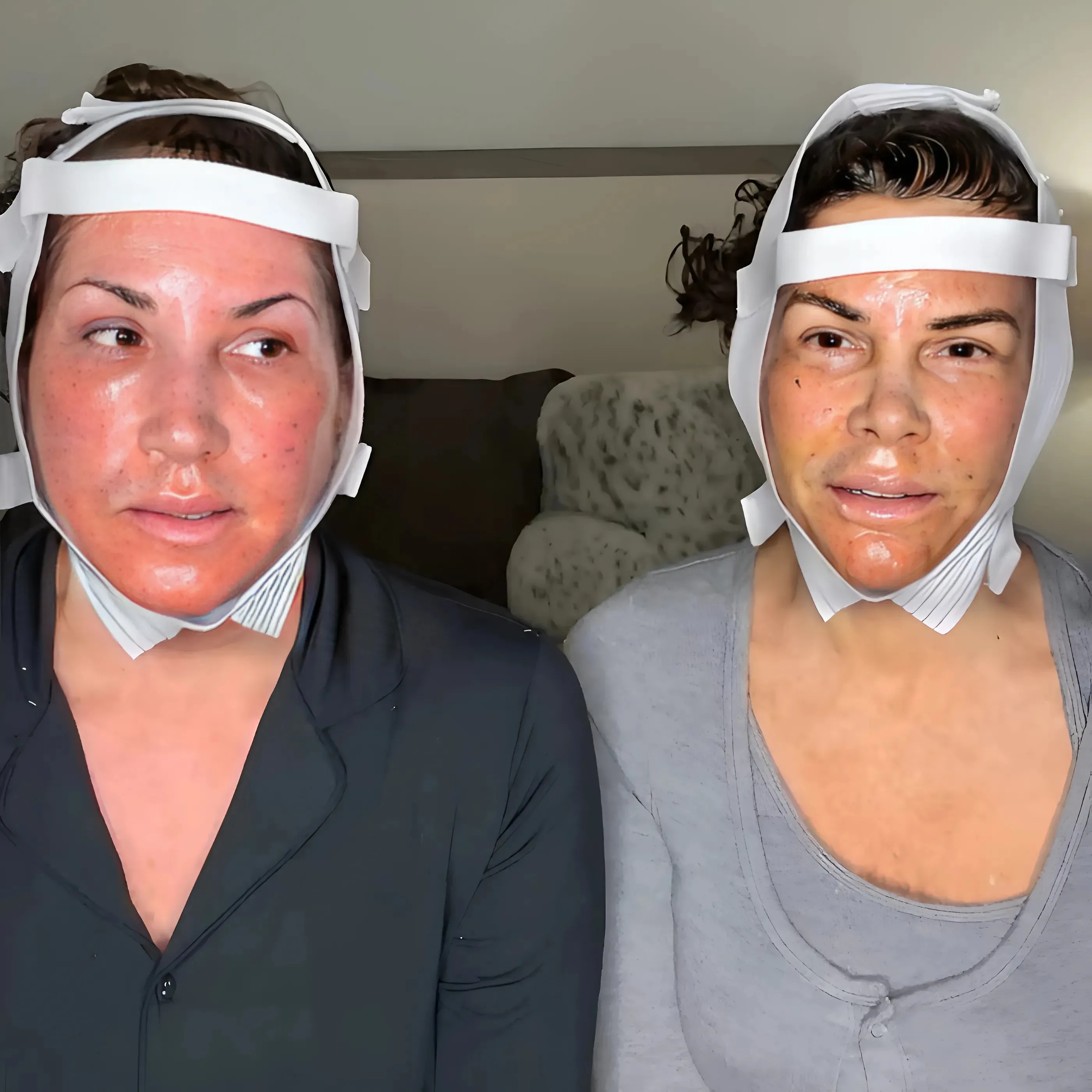 VIDEO : RHONJ’s Jacqueline Laurita Undergoes Facelift and Neck Lift With Lynne Curtin, Shares Post-Surgery Update as They Claim It “Doesn’t Even Hurt”