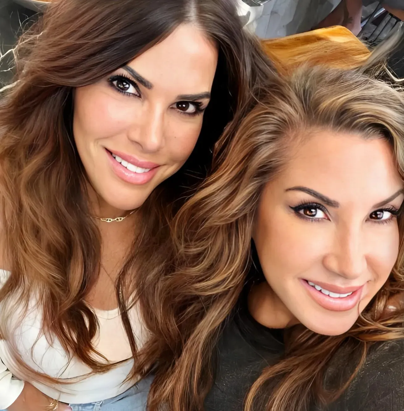 VIDEOS: RHONJ’s Jacqueline Laurita Undergoes Facelift and Neck Lift With Lynne Curtin, Shares Post-Surgery Update as They Claim It “Doesn’t Even Hurt”