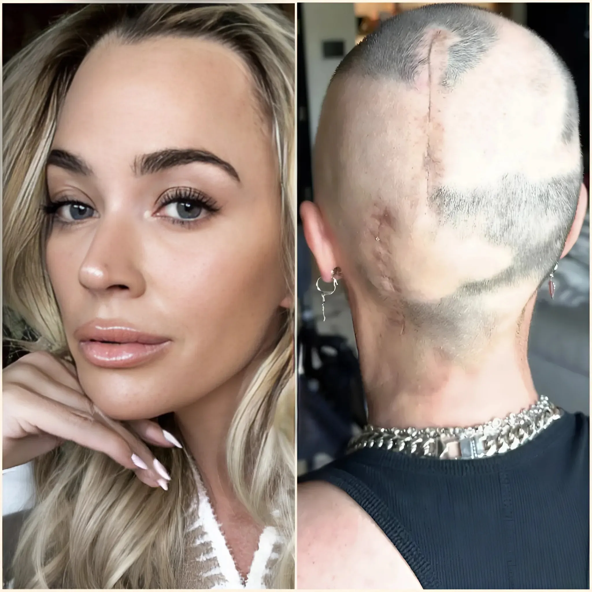 Teddi Mellencamp shares the heartbreaking reason she only occasionally wears a wig amid cancer battle