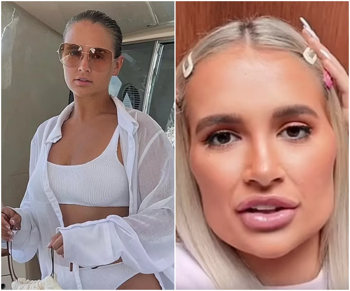 Molly-Mae Hague reveals insecurities over her 'stretch marks' and 'wide hips' after giving birth and reflects on 'unhealthy' filler obsession which saw her compared... - suong