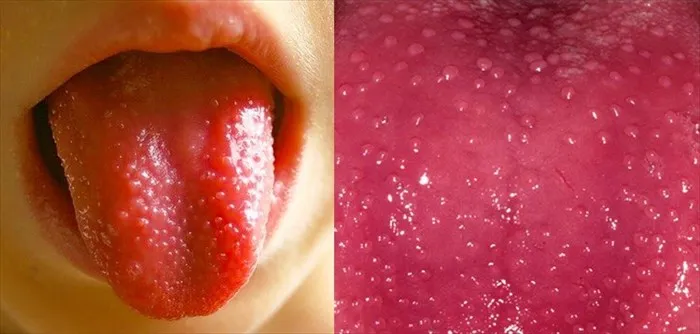 9. 8 Things That Your Tongue Tell You About Your Health...
