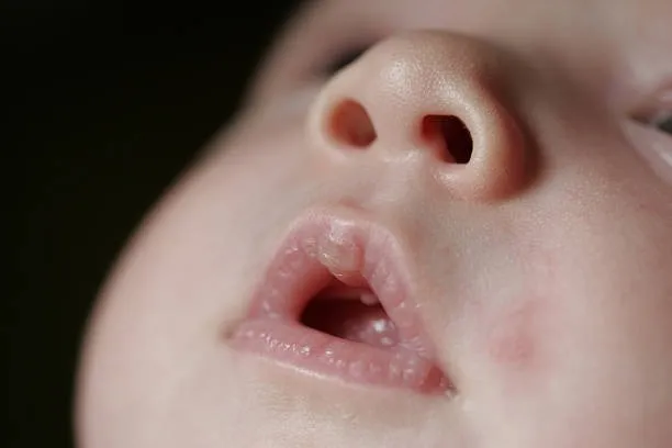 P2. If your baby has these marks it means… See more