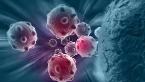 P4. Most Dangerous Cancers in Men and Women