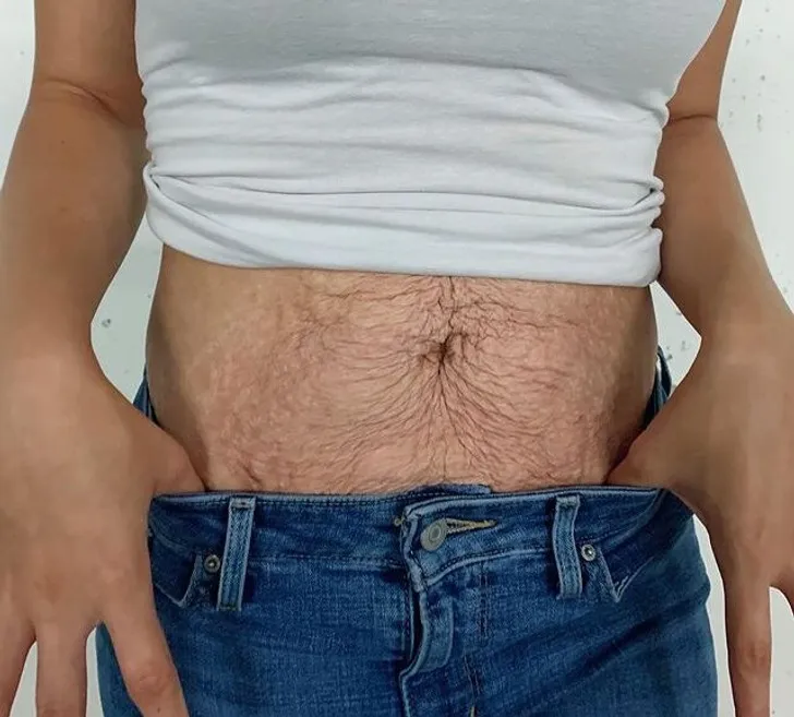9. Woman Shows the Raw Truth of Postpartum Bodies