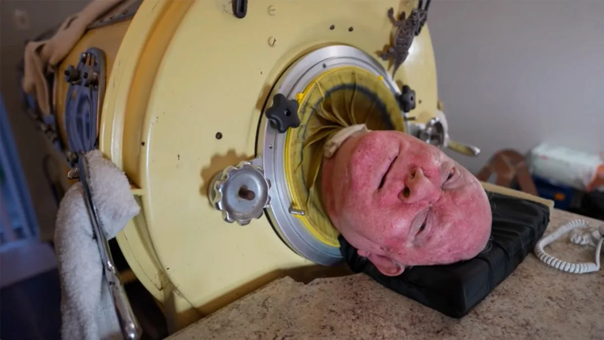9. Paralyzed from polio at 6, he was one of the last people with an iron lung – but now there is a sad update