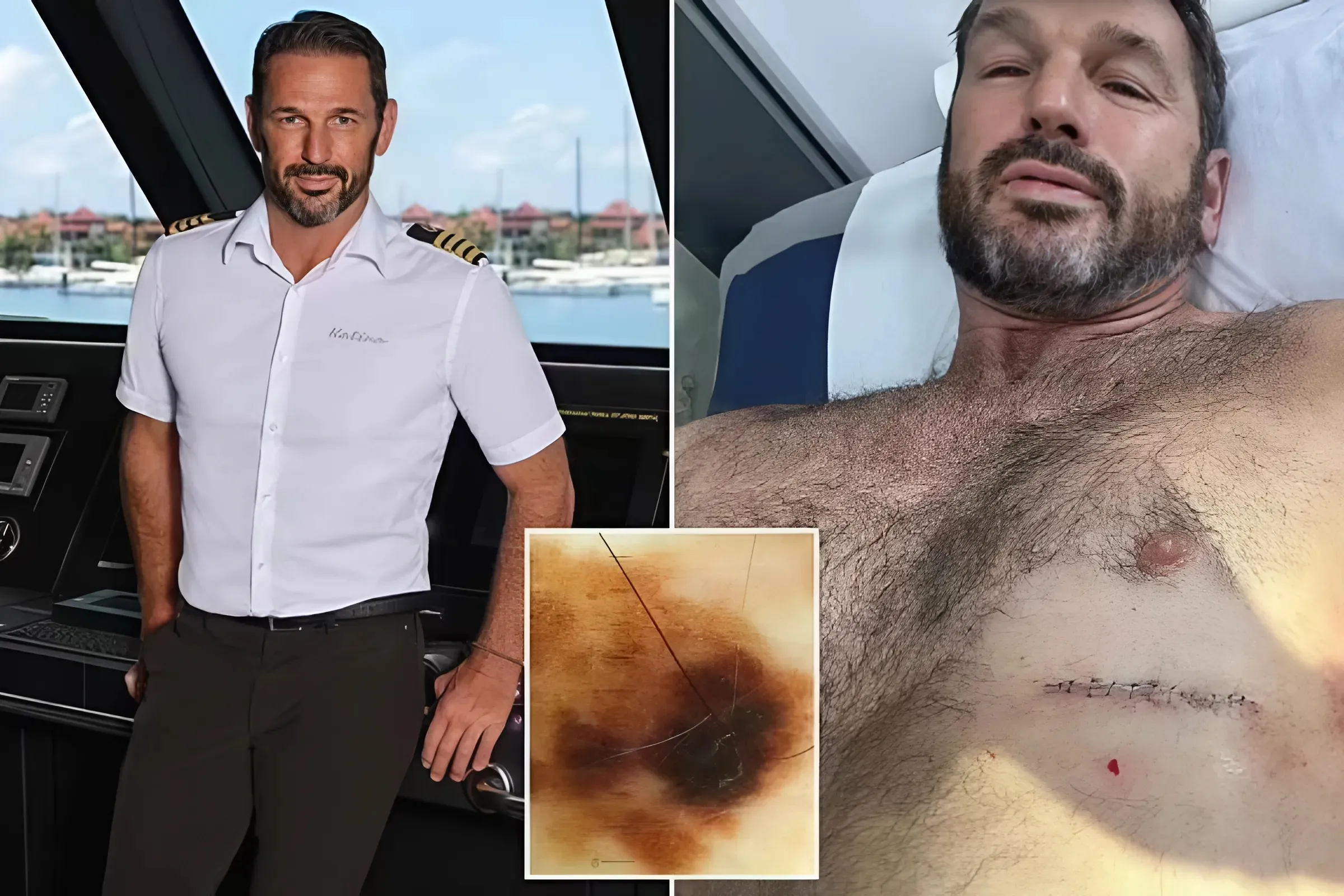 Below Deck star reveals hidden battle with cancer... and the sign he ignored because he was 'naive'