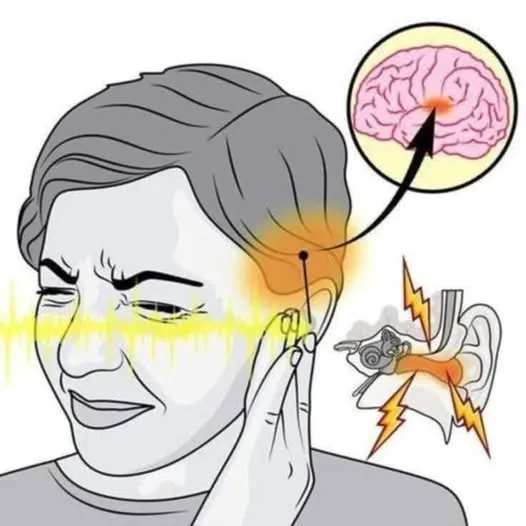 If you hear ringing in your ear, this is a sign that you will suffer from…