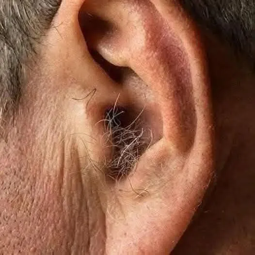 DID YOU KNOW that if hair grows on your ears, it’s because your body is…. Read more DID YOU KNOW that if hair grows on your ears, it’s because your body is…. Read more